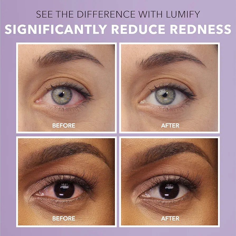LUMIFY Eye Drops for Red Eyes, Redness Reliever for Brighter Looking Eyes, Works in 1 Minute & Lasts Up to 8 Hours, Eye Drops, 0.25 Fl Oz (7.5mL)